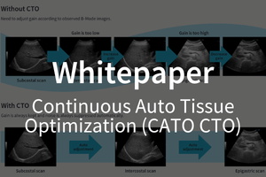 Whitepaper / Continuous Auto Tissue Optimization (CATO CTO)